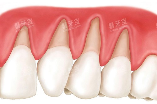 ����Ш״ȱ��ͨͼ