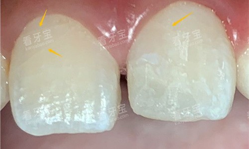 ��������չʾͼ