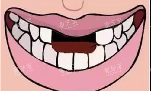 ����ȱʧ��ͨͼ