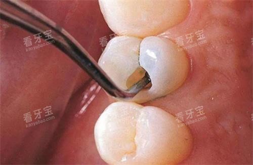 ������ʾ��ͼ