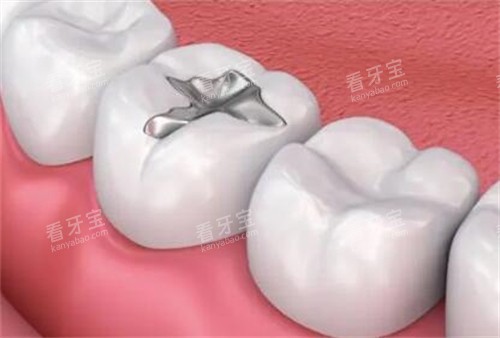 ��������չʾ��Ƭͼ