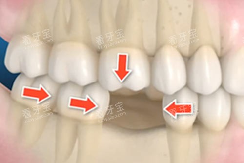 ����ȱһ�Ų�����Ӱ��ͼ