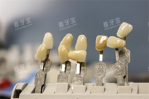 ��ݲ���չʾ