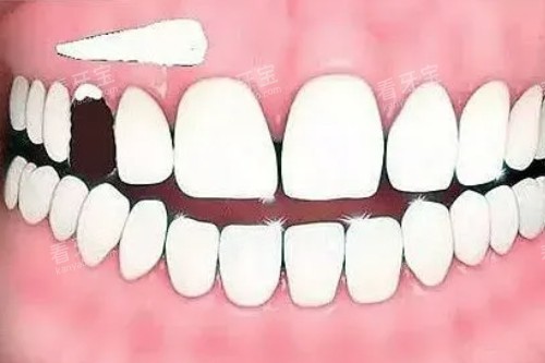 ����ȱ��ͨͼ