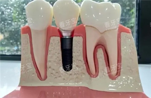 ��ֲ������ģ��ͼƬ 