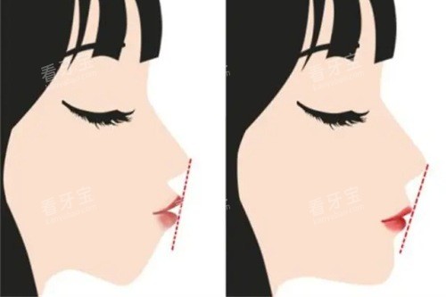 �������ǰ��ĶԱ�ͼ