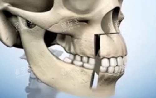 �������ͼʾ