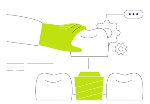 װ����ʾ��ͼ