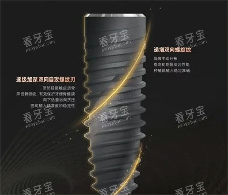 卡尔斯种植牙种植体螺纹照片 卡尔斯种植牙种植体螺纹照片