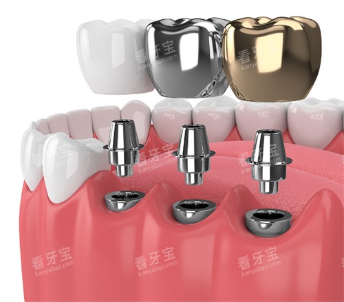 ���ɿ�ǻ2026�°��շѼ�Ŀ��������2980Ԫ�����ݽ���8000Ԫ������1000Ԫ��