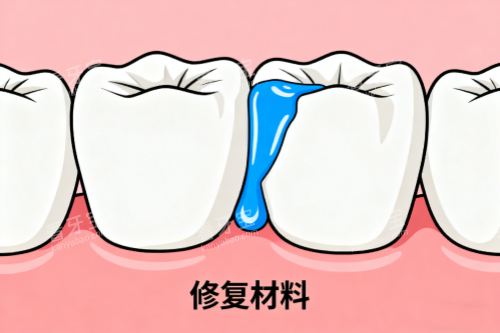 �����޸�����չʾͼ