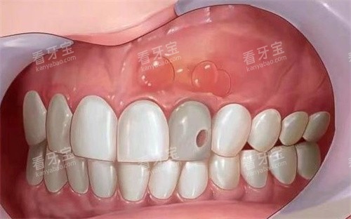 ����������ʲô��ͨͼ