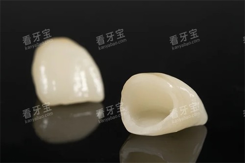 两颗全瓷牙牙冠实物展示图 两颗全瓷牙牙冠实物展示图