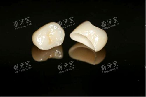 两颗全瓷牙冠实物图 两颗全瓷牙冠实物图