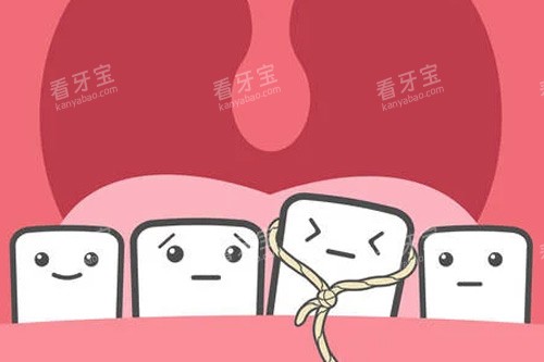 乳牙滞留拔除示意图 乳牙滞留拔除示意图
