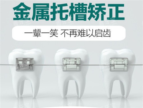 金属托槽矫正图 金属托槽矫正图