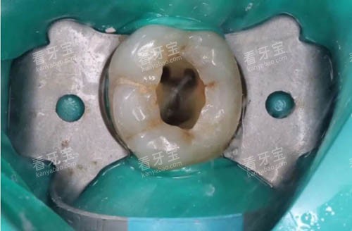 ��������ϸ��ͼ