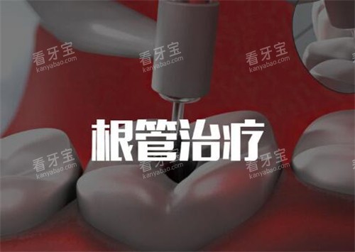 深圳根管治疗一颗牙多少钱?单根管600元起、双根管800元起、后磨牙根管1000元起