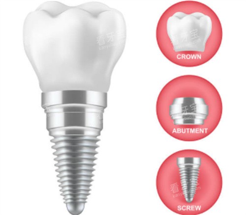 ��ֲ����������