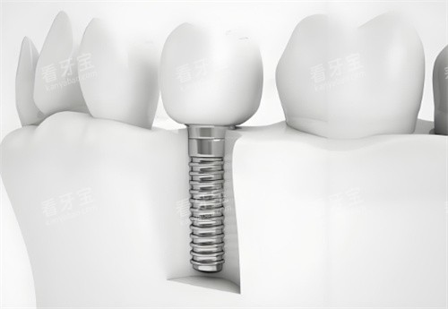 ��ֲ��ģ��ͼƬ