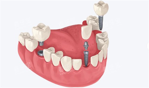 ���ľ�ҽ��ѧ��ǻҽԺ�Һ�ԤԼ����źţ��绰ԤԼ������ԤԼ���ֳ�ԤԼ�ȷ�ʽ���ܹҺţ�