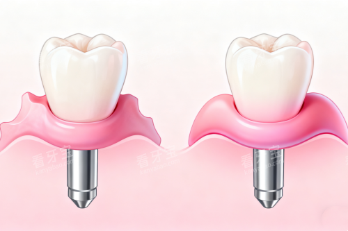 ��ֲ��ֲ���ǻչʾ