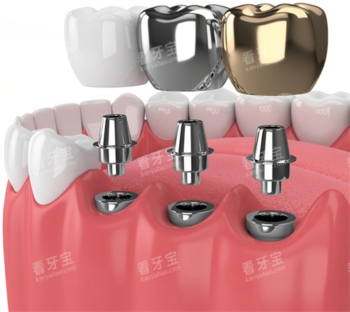 ��ֲ������ʾ��ͼչʾ