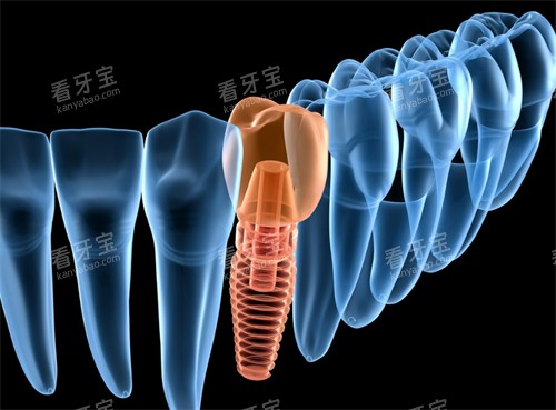 ������ֲ����ʾͼ