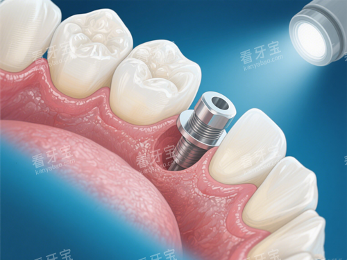 ��ֲ������ʾ��ͼ