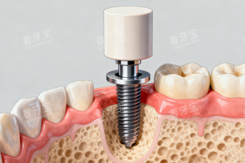 ��ֲ��ֲ���ǻ��ͨչʾͼ