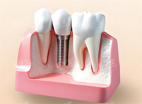 ��ֲ��ģ�ͽ���չʾ