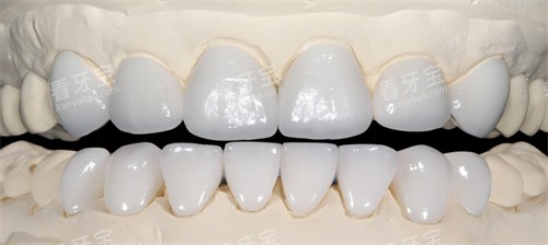 ȫ�����Ĺ������ɫ