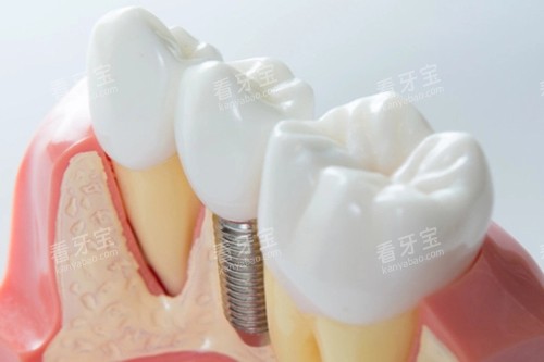 ������ֲ��ģ��ʾ��ͼ