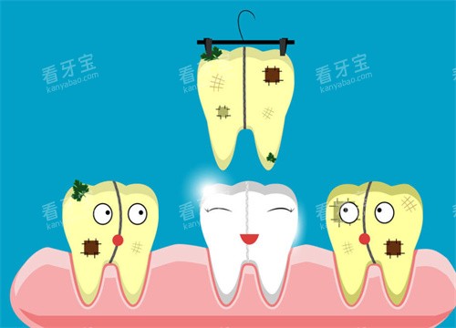 牙齿清洁卡通图片 牙齿清洁卡通图片