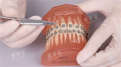 ���������в۽�����ô����