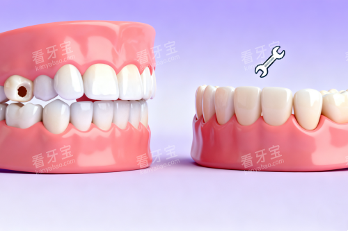 牙齿蛀牙修复卡通图 牙齿蛀牙修复卡通图