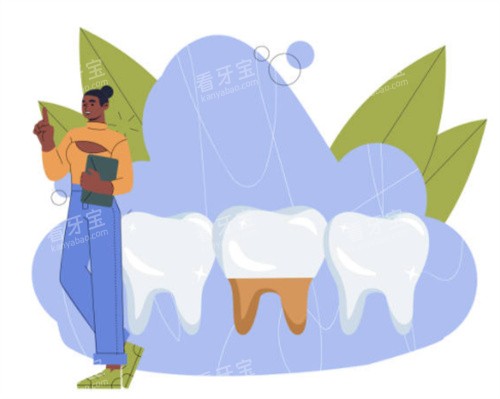 ��ֲ��ģ��ͼ