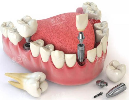 ��ֲ����ͨ�ο�ͼ