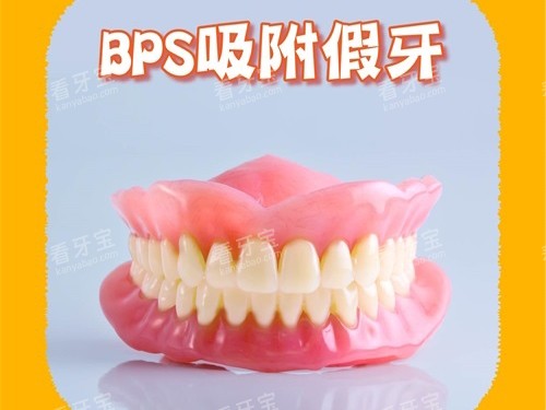 2026中诺口腔吸附性义齿价格分层解析,含BPS工艺、树脂钛合金基托各档报价,半全口差异讲清!