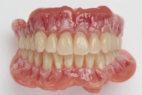 吸附性义齿模型图片展示 吸附性义齿模型图片展示