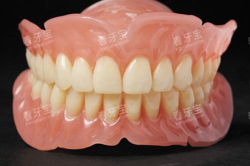 吸附性义齿模型图 吸附性义齿模型图