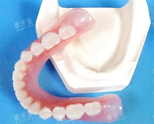 吸附性义齿 吸附性义齿