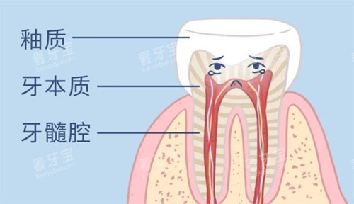 牙齿变黄怎么办 牙齿变黄怎么办