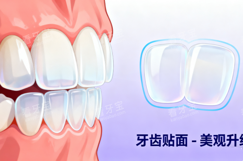 牙齿贴面美白牙齿卡通图 牙齿贴面美白牙齿卡通图