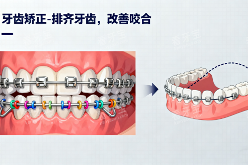 �������ݽ�����ͨչʾͼ