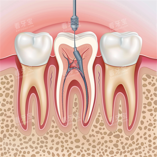 ���ݸ�������������������ͼ