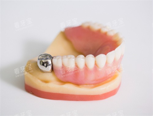 牙齿模型通用 牙齿模型通用