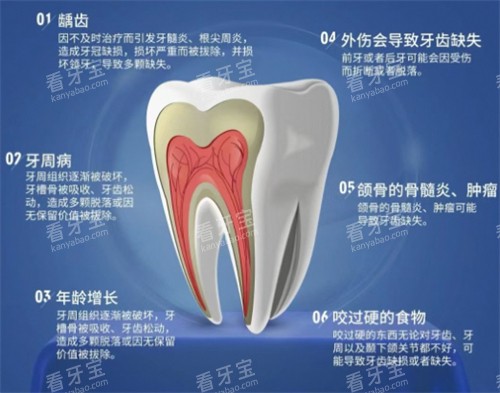 ����ȱʧԭ��