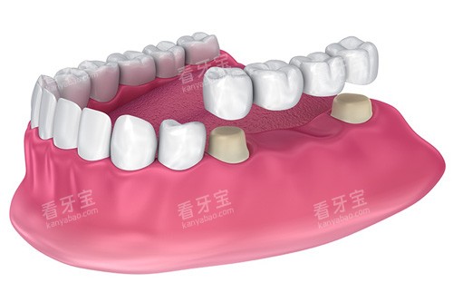 ȫ����������޸�ʾ��ͼ