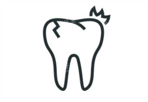 种植牙牙裂示意图 种植牙牙裂示意图